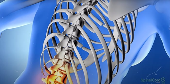 Lumbar Spine Injury L1-L5 | Spinal Cord